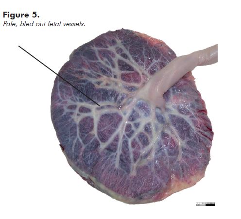 Figure 5. Pale, bled out fetal vessels.