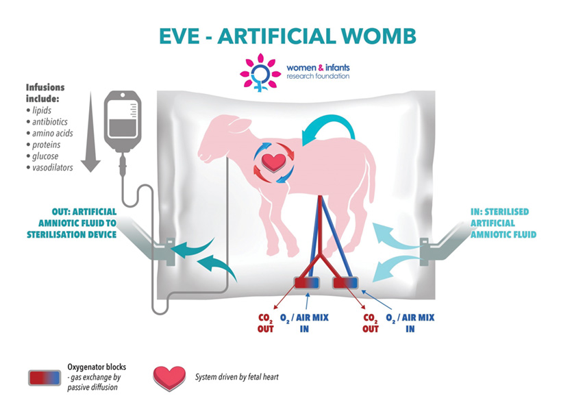 EVE artificial womb