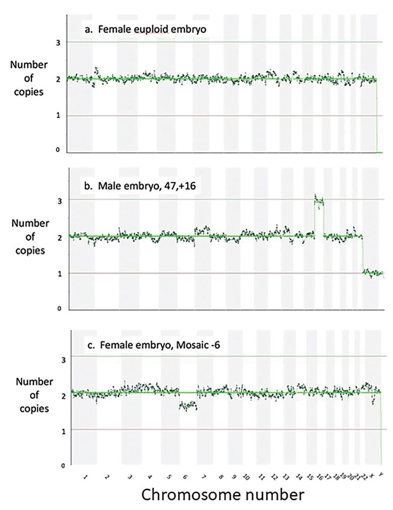 Figure 3. The readouts after next generation sequencing, showing the chromosome count for each chromosome for (a) a female euploid embryo (b) a male aneuploid embryo with an extra Chromosome 16 and (c) a female embryo mosaic for a missing Chromosome 6. 