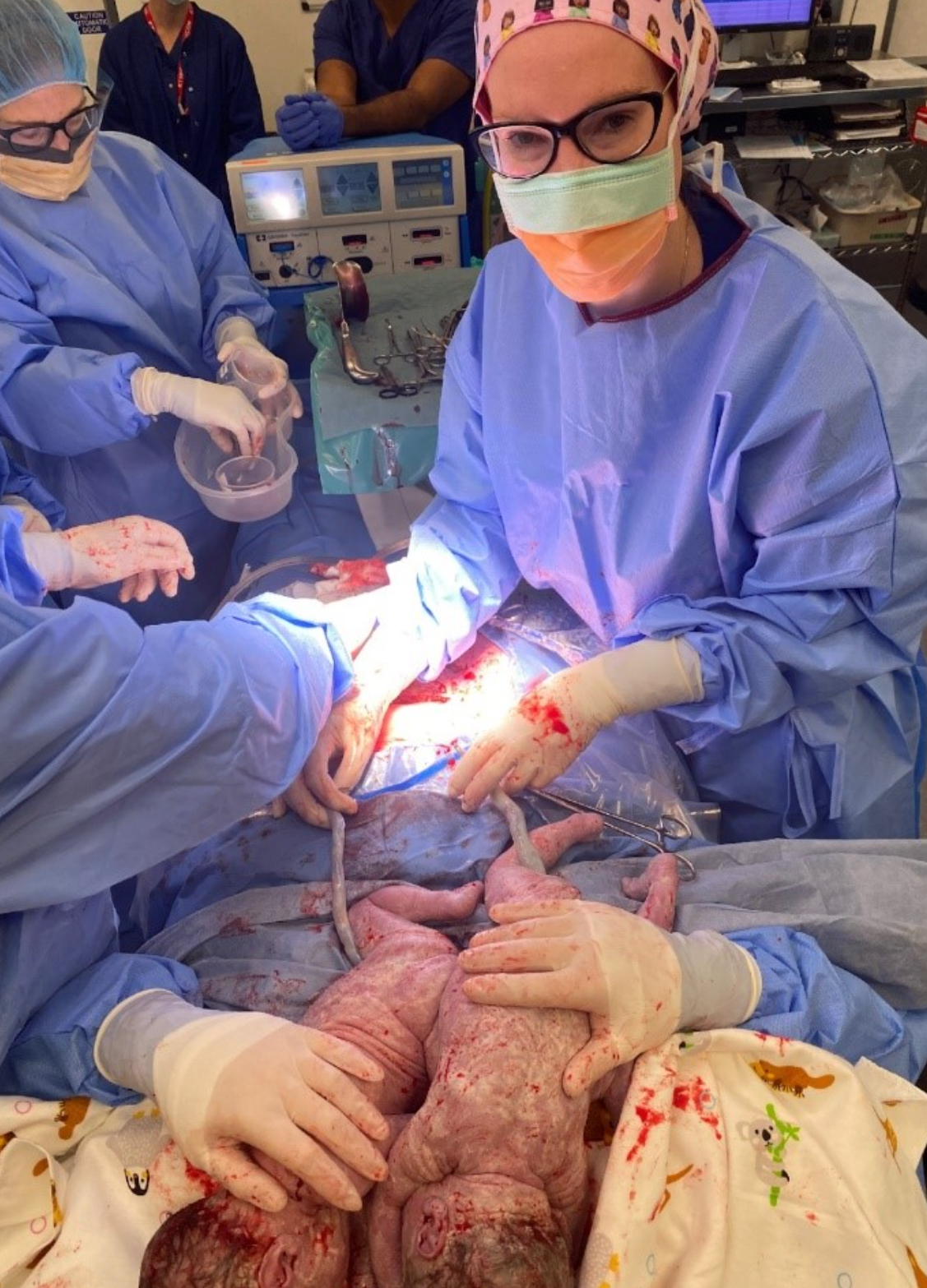 Suzanne Meharry with Tina Blacklock (out of the picture) and her baby twins during a maternally assisted caesarean.