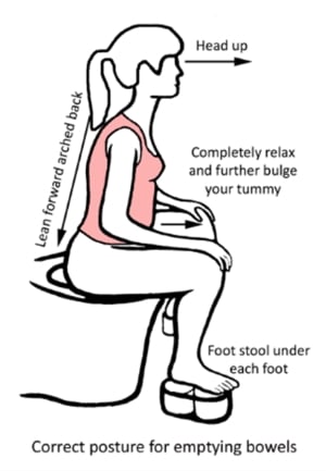 Diagram of correct posture to empty bowels, leaning forward with arched back, head up, completely relax and further bulge your tummy, foot stool under each foot.