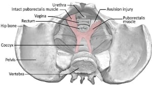 Diagram of pelvic floor