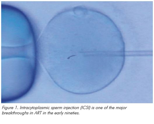 Figure 1. Intracytoplasmic sperm injection (ICSI) is one of the major breakthroughs in ART in the early nineties.