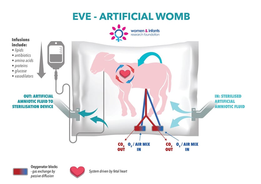 EVE artificial womb