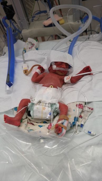 Lewis Beedie in his NICU crib.