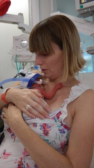 Joanne and Lewis Beedie, sharing their very first cuddle and valuable skin-to-skin time.