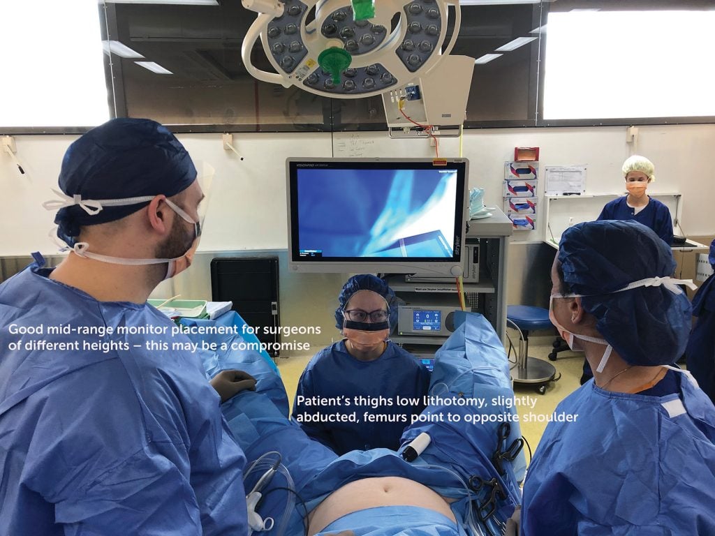 Ergonomics of laparoscopic surgery Figure 1