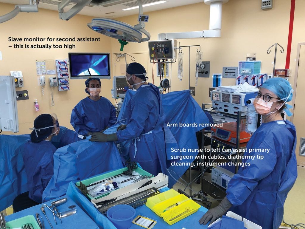 Ergonomics of laparoscopic surgery Figure 2