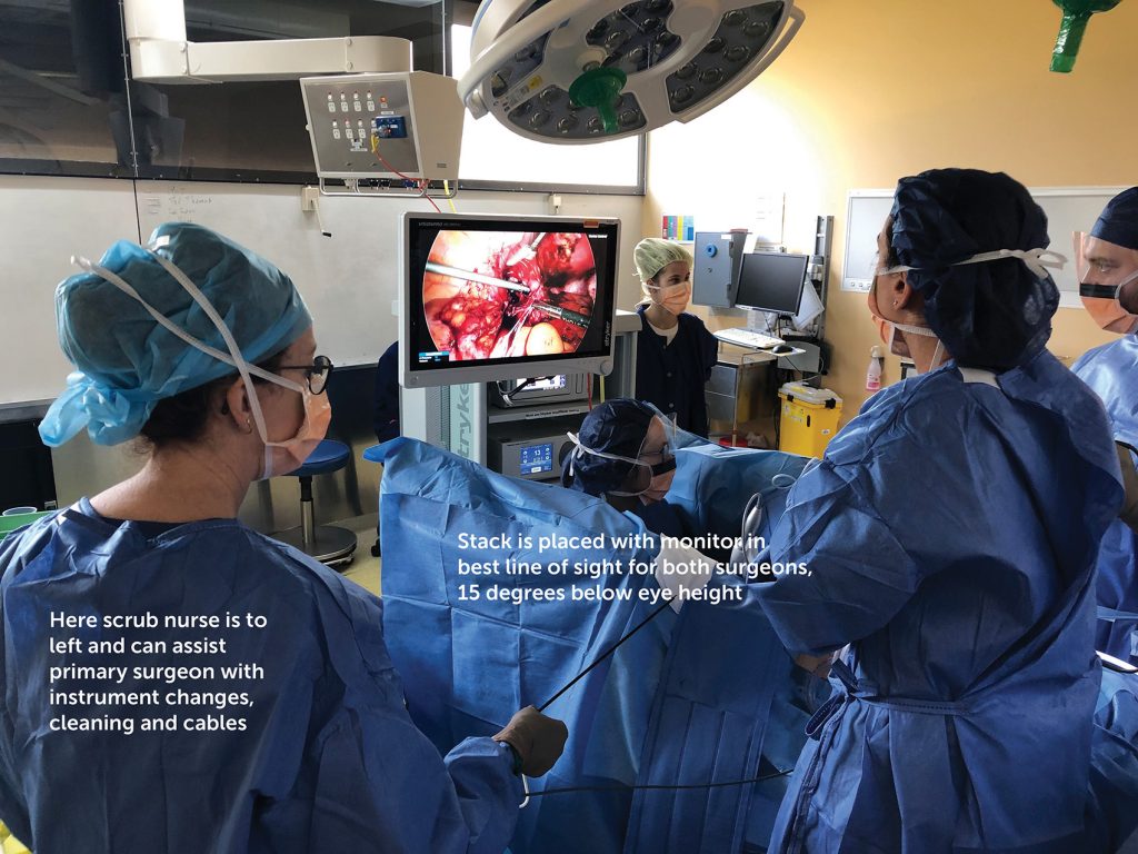 Ergonomics of laparoscopic surgery Figure 4