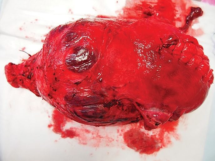 massive transfusion protocol massive transfusion protocol