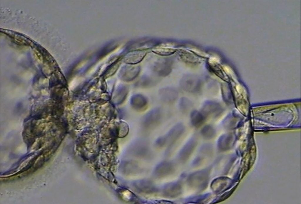 Figure 2. An embryo being biopsied for preimplantation genetic testing.