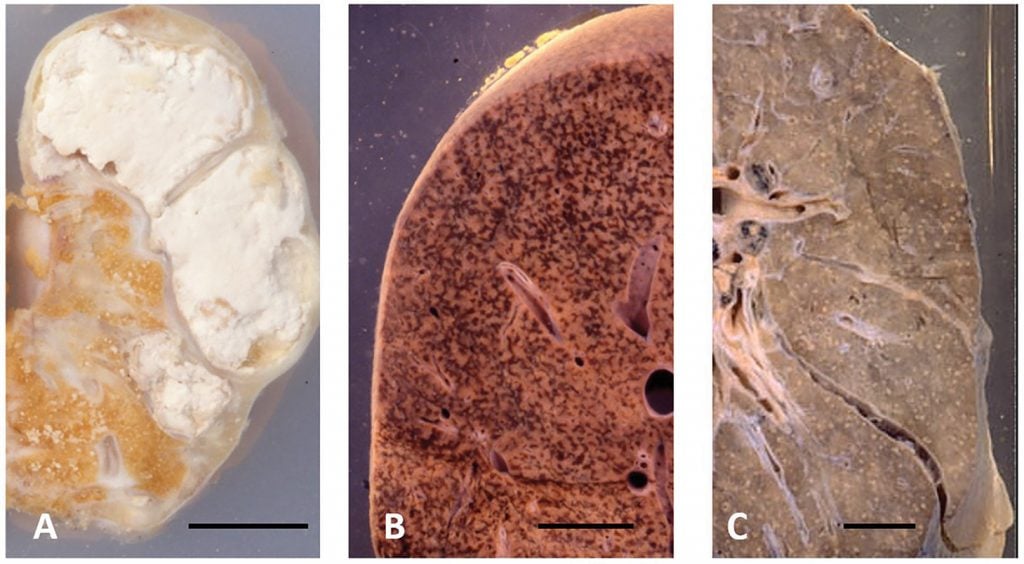 Figure 1. Macroscopic specimens illustrating changes traditionally described using food-related terminology