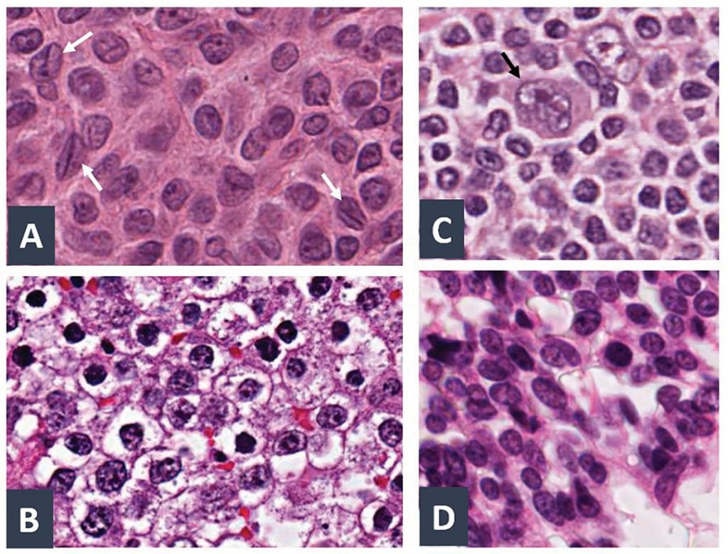 Figure 2. High-magnification photomicrographs illustrating cell nuclei traditionally described using food-related terminology