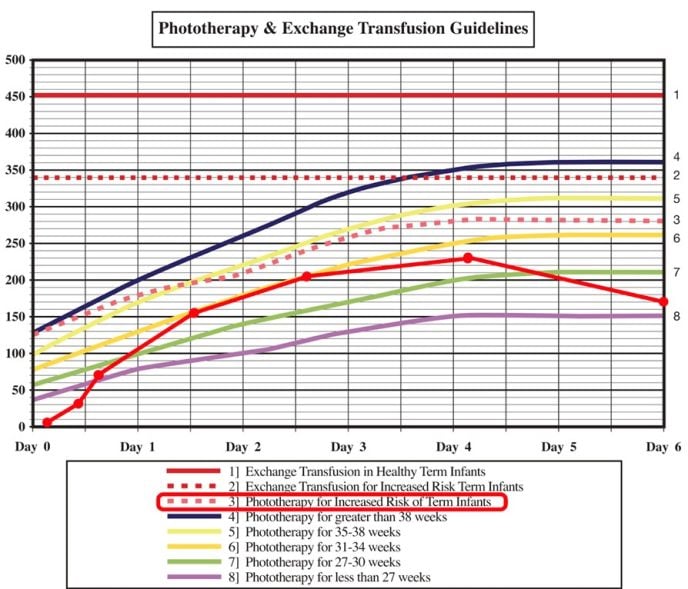 Figure 2. Example of inpatient bilirubin monitoring using a standardised nomogram. This 38-week macrosomic baby was born by ventouse and sustained a significant cephalohaematoma, thus monitoring their levels accordingly by line ‘3’. Concern for increasing jaundice and poor feeds lead to close bilirubin monitoring. They were discharged on the fourth day of life and had a follow-up heel prick bilirubin on day 6 with improving bilirubin levels, without further follow up. Adapted from Tasmanian Health Service South Guidelines, 2023.